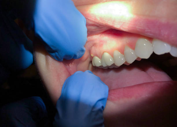 Best Emergency Gum Pain Relief  in Victor, ID