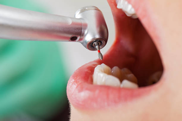 Best Dentist for Tooth Abscess  in Victor, ID